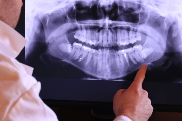 Best Emergency Tooth Extraction in North New Hyde Park, NY